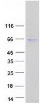 SDS-PAGE (PNPLA2-251HFL).jpg